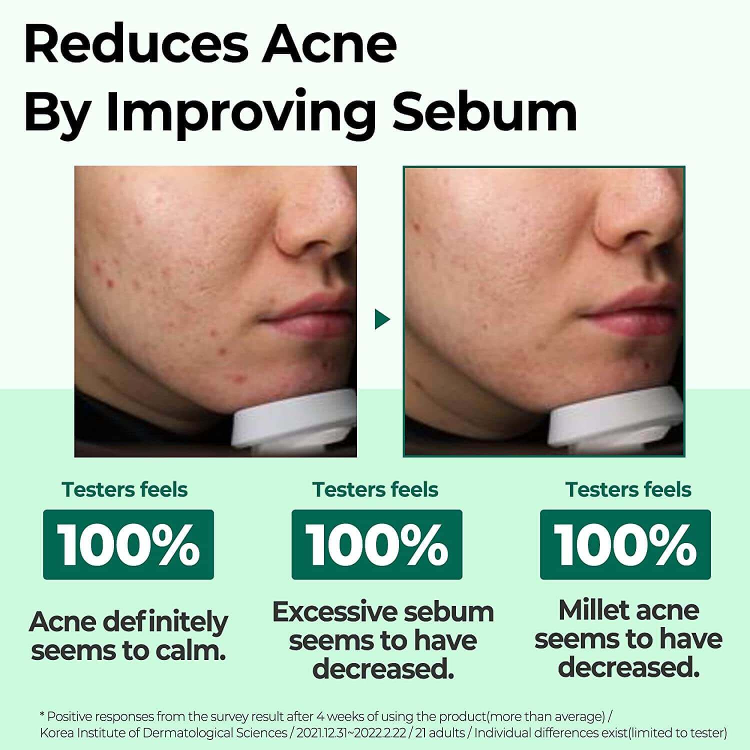 Some By Mi AHA BHA PHA 30 Days Miracle Serum - Exfoliating & Clarifying Facial Serum